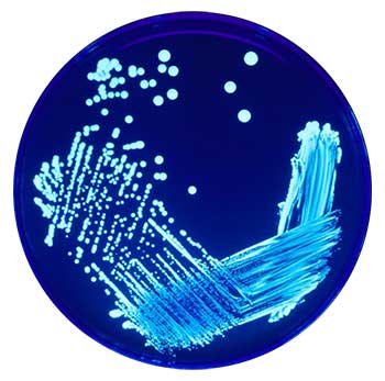Legionella sp. under UV light